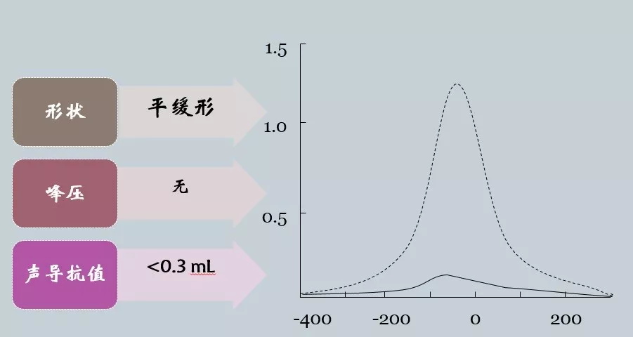 听力知识