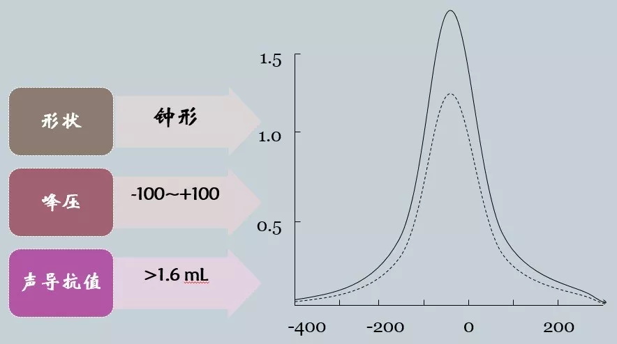 听力知识