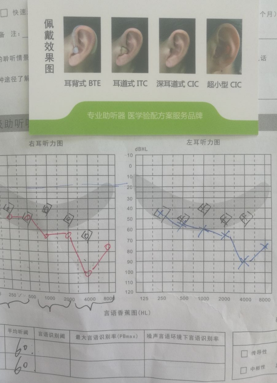 助听器价格