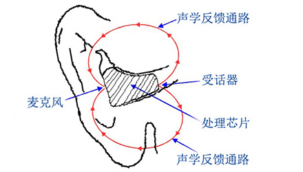 助听器知识