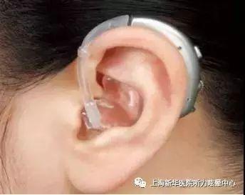 助听器知识