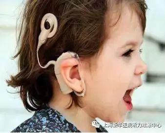 助听器知识