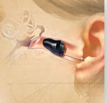 助听器知识