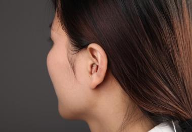 双耳佩戴助听器时是否需要戴同一牌子的？