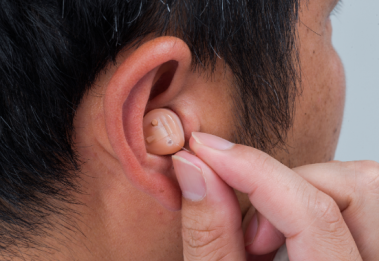 助听器常见的故障有哪些，如何处理？