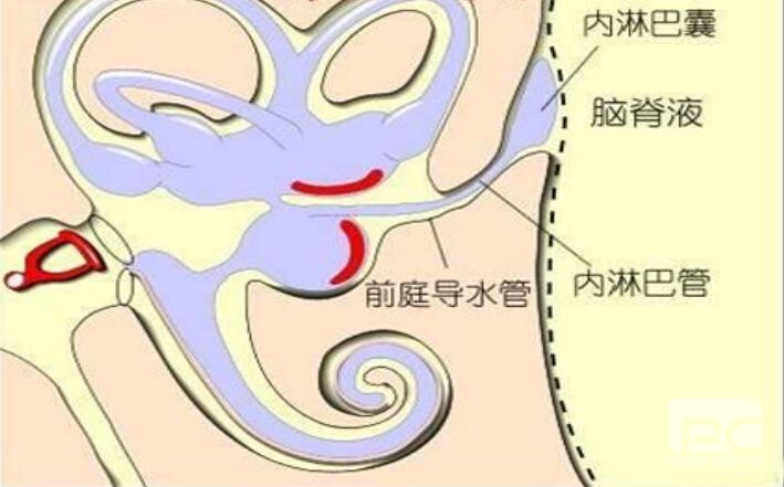 前庭导水管图片