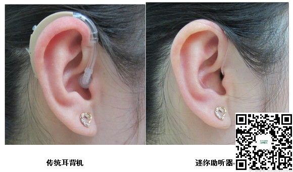 传统耳背机与迷你助听器外观对比
